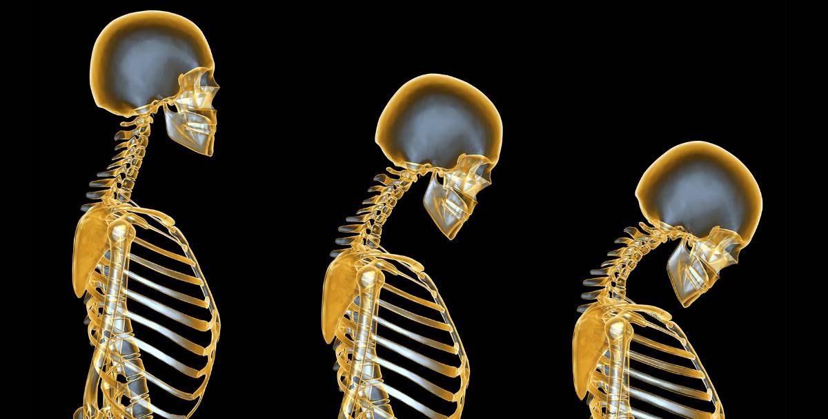 θεραπεια οστεοπορωσησ