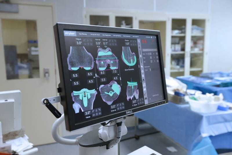 ψηφιακα υποβοηθουμενη αρθροπλαστικη γονατοσ